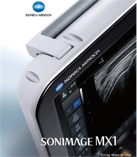 SONIMAGE MX1 - Máy siêu âm xách tay